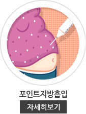 지방흡입(mini)